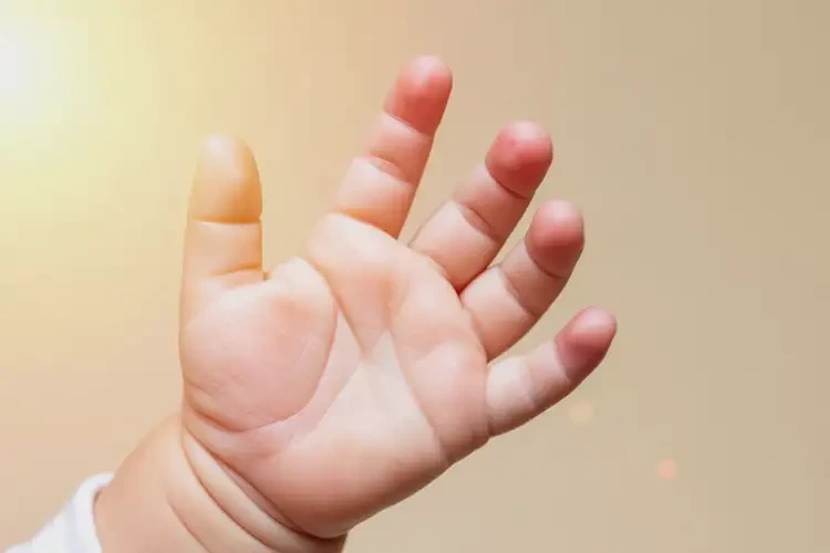 婴儿手上起湿疹能治好吗(图3)