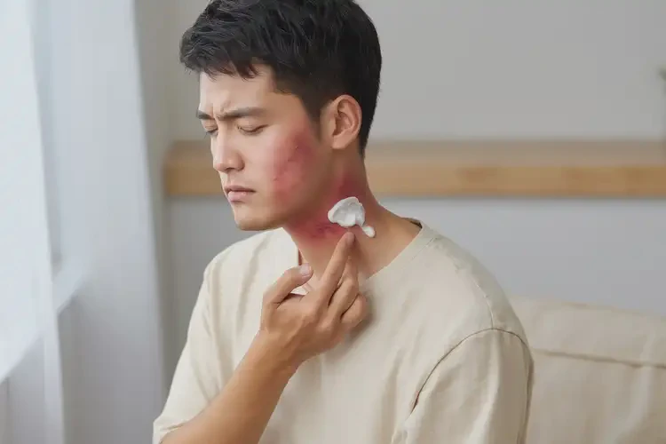 男人脖子上偶尔长湿疹可以治好吗(图2)