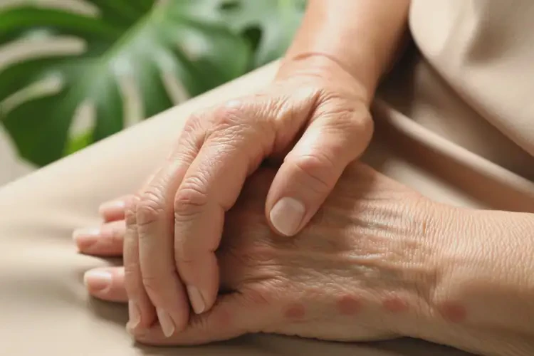 老年人手上起湿疹可以治好吗(图4)