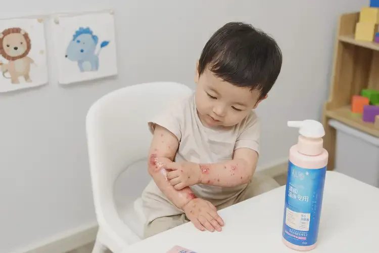 小儿手上偶尔长湿疹可以治好吗(图2)