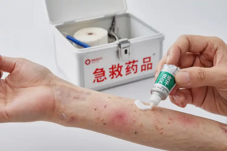 女人全身偶尔长湿疹能够彻底治愈吗(图1)