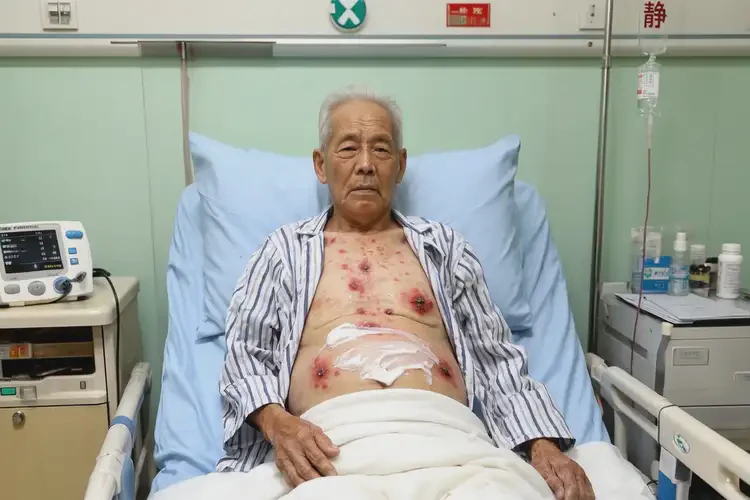 高龄老人肚子上经常长湿疹不管它会自己好吗(图3)