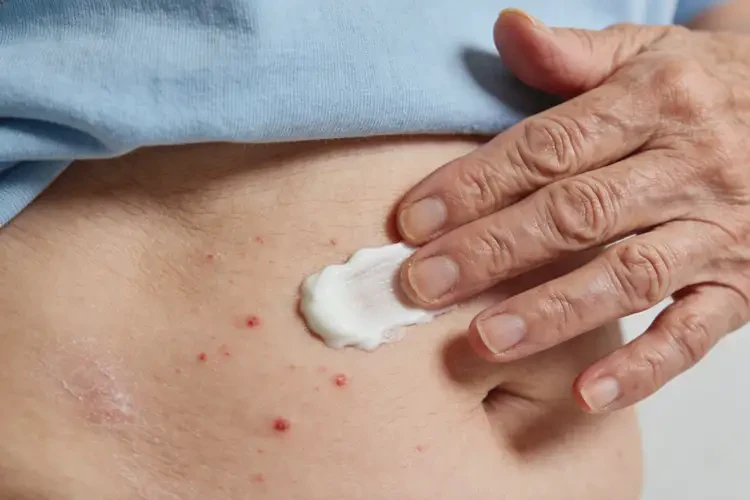 老年人肚子偶尔起湿疹可以治好吗(图2)