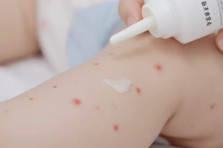 婴儿大腿上容易长湿疹能治好吗(图3)