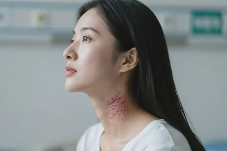 女人脖子出现湿疹可以治好吗(图2)