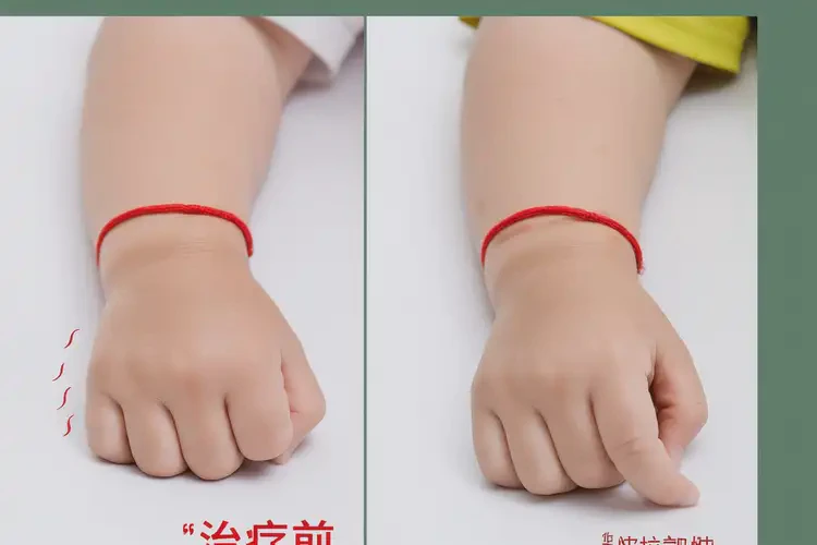 宝宝脚上起湿疹能治好吗(图4)