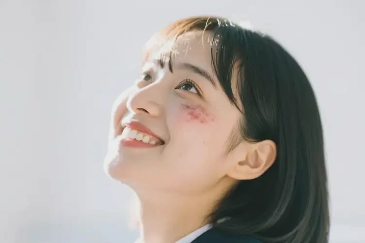 大学生脸上出现湿疹可以治好吗(图1)