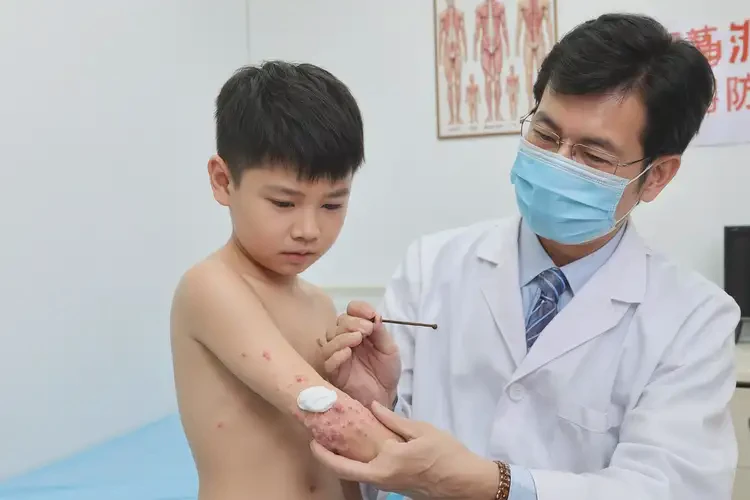 小儿全身出湿疹不管它会自己好吗(图3)