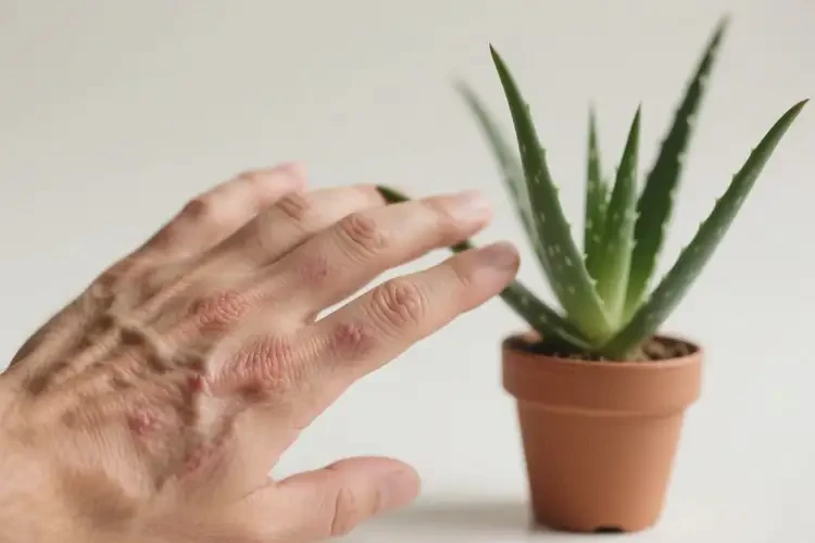 男性手上起湿疹可以治好吗(图4)