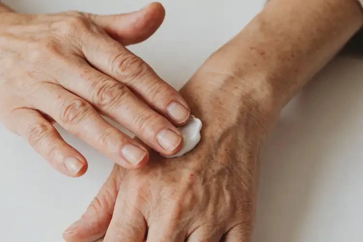 老年人手上出现湿疹不管它会自己痊愈吗(图1)