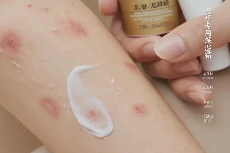 男人手臂偶尔长湿疹可不可以彻底自愈(图3)