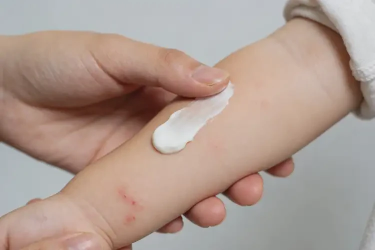 儿童手臂经常起湿疹可不可以彻底自愈(图2)