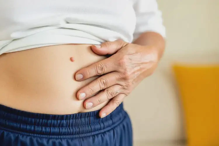 高龄老人肚子偶尔起湿疹可以治好吗(图2)