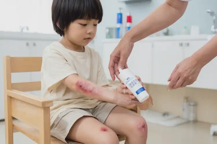 少儿全身出现湿疹能够彻底治愈吗(图2)