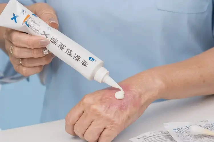 女人屁股上有湿疹可以治好吗(图3)