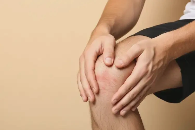 男人四肢偶尔起湿疹可以治好吗(图4)