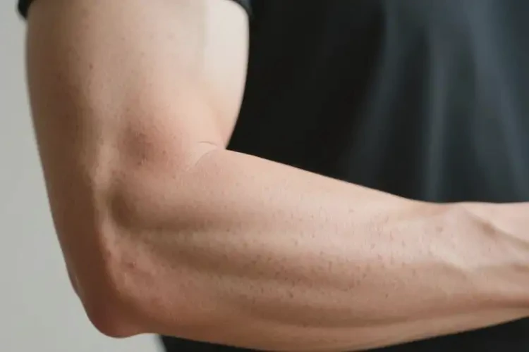 男人手臂容易起湿疹可以治好吗(图2)