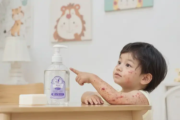 小儿全身出湿疹不管它会自己好吗(图1)