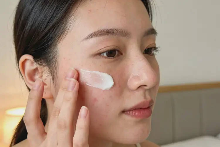 哺乳期妈妈脸上长湿疹可以治好吗(图2)