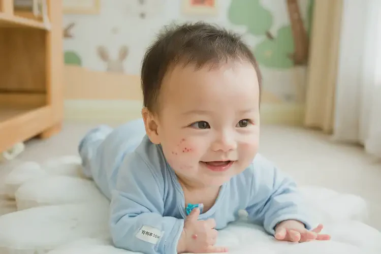 婴儿脖子出现湿疹能治好吗(图2)