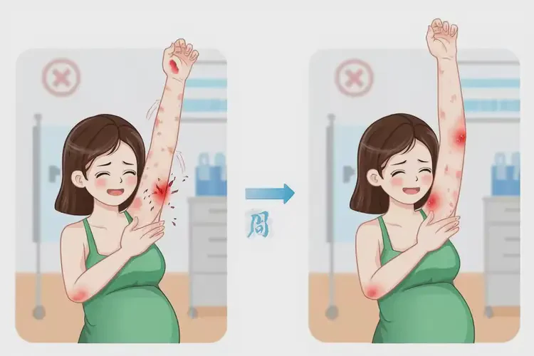 孕妇手臂出现湿疹能治好吗(图4)