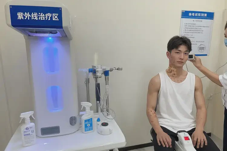 青年人脖子容易长湿疹不管它会自己自愈吗(图2)