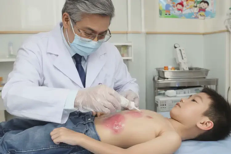 小孩肚子上出现湿疹能治好吗(图3)