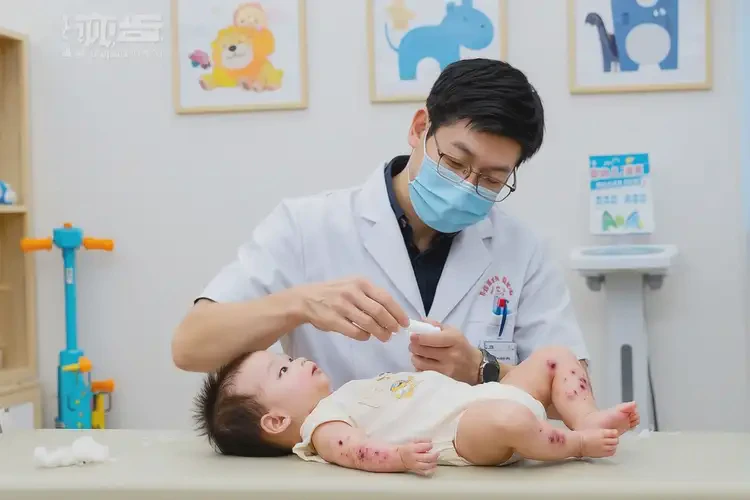 婴幼儿四肢起湿疹能治好吗(图2)