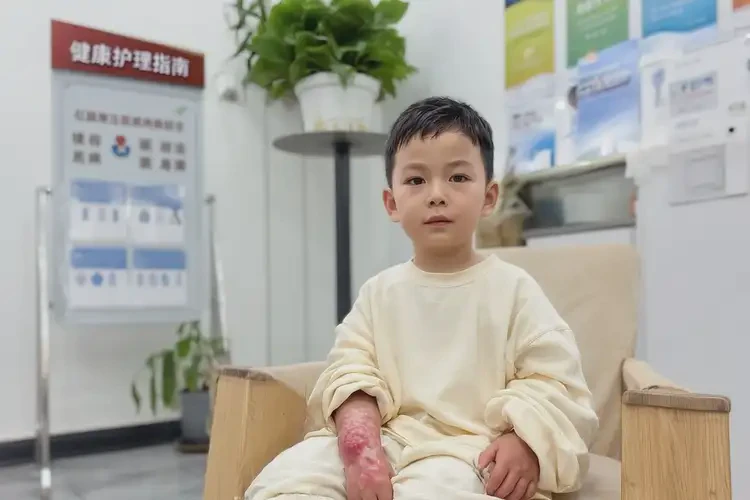 孩子手臂上容易起湿疹能治好吗(图2)