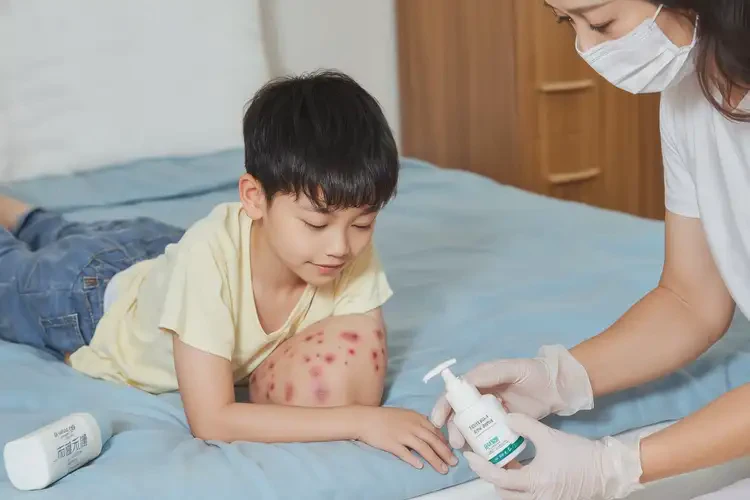 儿童肚子偶尔长湿疹能治好吗(图1)