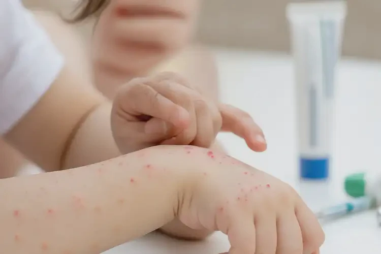 孩子屁股上偶尔起湿疹能治好吗(图4)