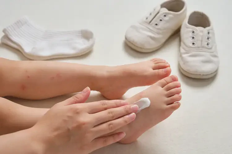 小孩脚上偶尔起湿疹不管它会自己自愈吗(图3)