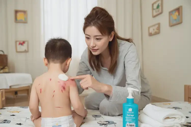 小孩屁股长湿疹不管它会自己好吗(图3)