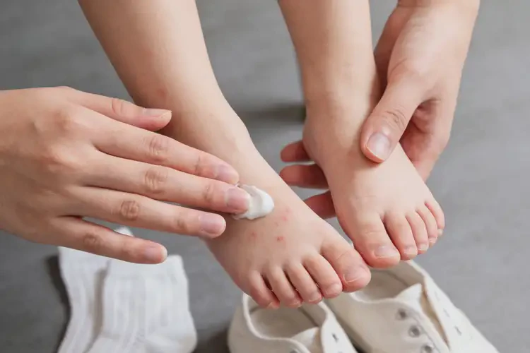 小孩脚上偶尔起湿疹不管它会自己自愈吗(图4)