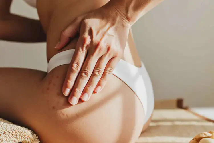 女性屁股上起湿疹能治好吗(图1)