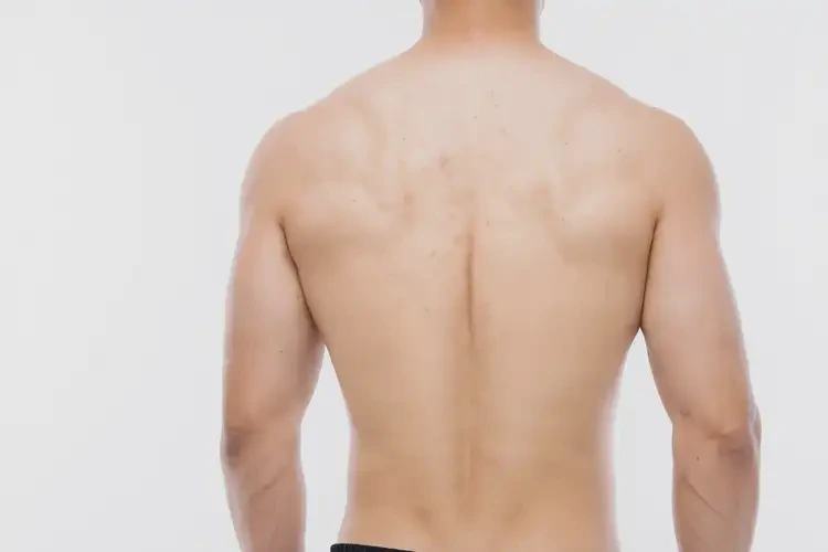 男性屁股上偶尔长湿疹能治好吗(图1)