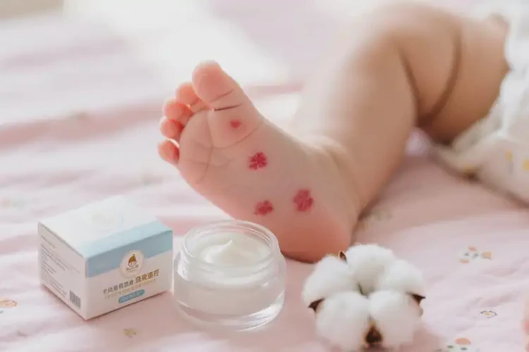 婴儿脚上偶尔长湿疹能治好吗(图2)