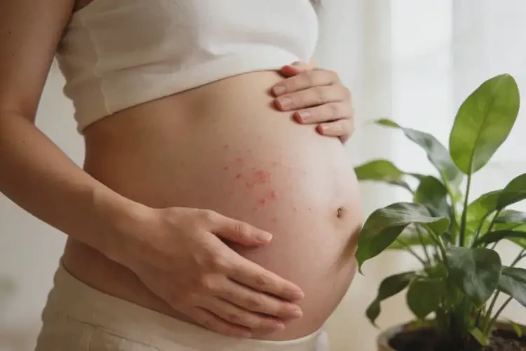 孕妇肚子长湿疹能治好吗(图3)