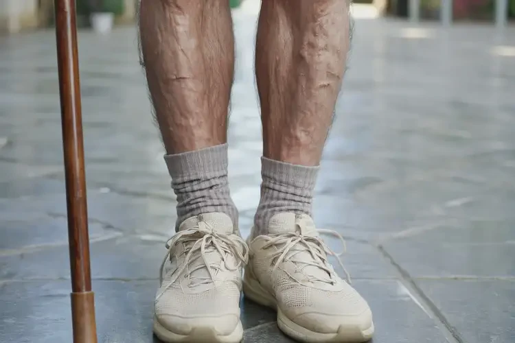 老人脚上长湿疹能治好吗(图3)