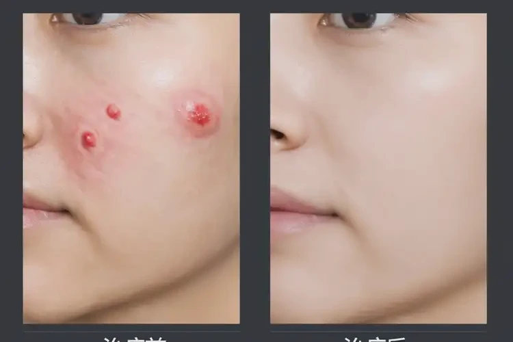 男性四肢起湿疹能治好吗(图4)