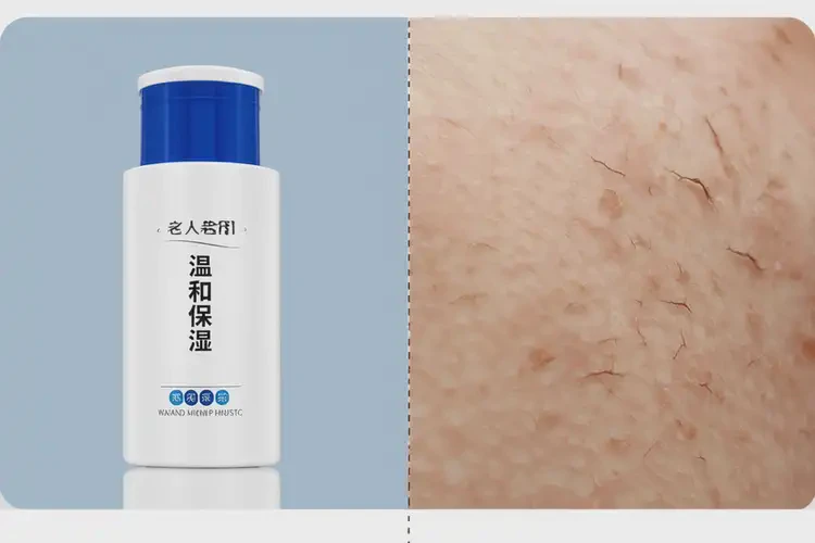 老年人大腿上容易起湿疹能治好吗(图3)