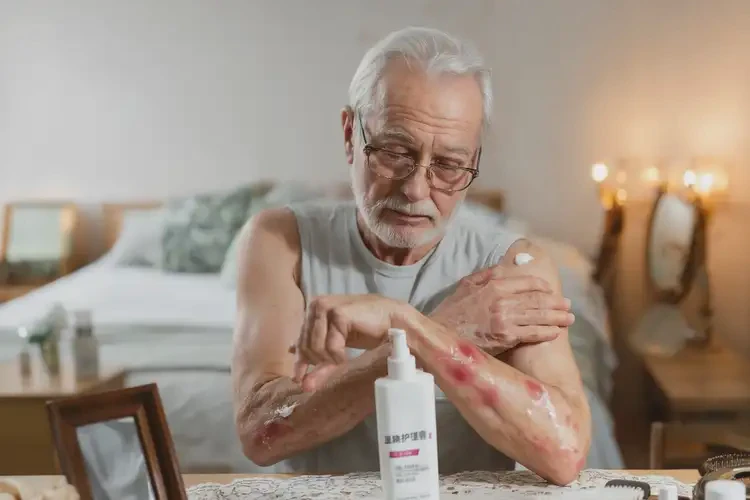 老年人手臂上起湿疹能治好吗(图2)