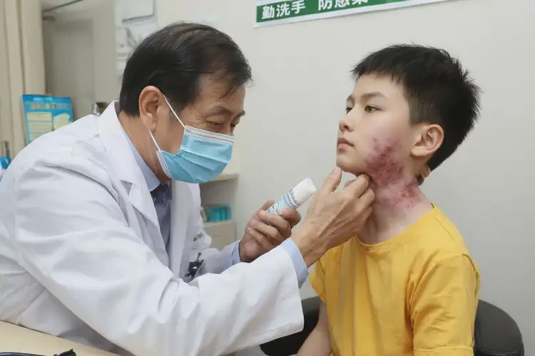 孩子脖子出湿疹能彻底自愈吗(图3)