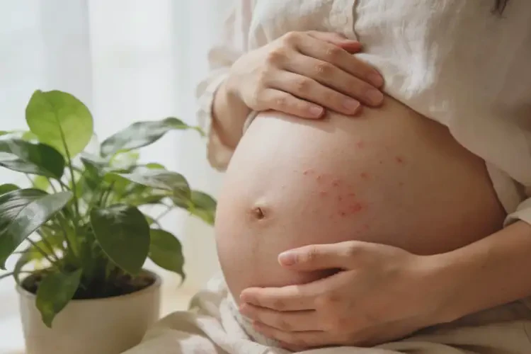 孕妇肚子长湿疹能治好吗(图4)