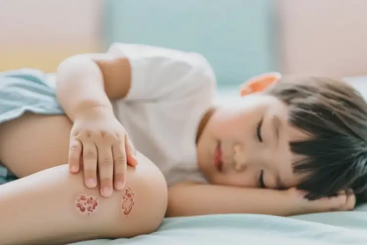 孩子大腿偶尔长湿疹能治好吗(图1)