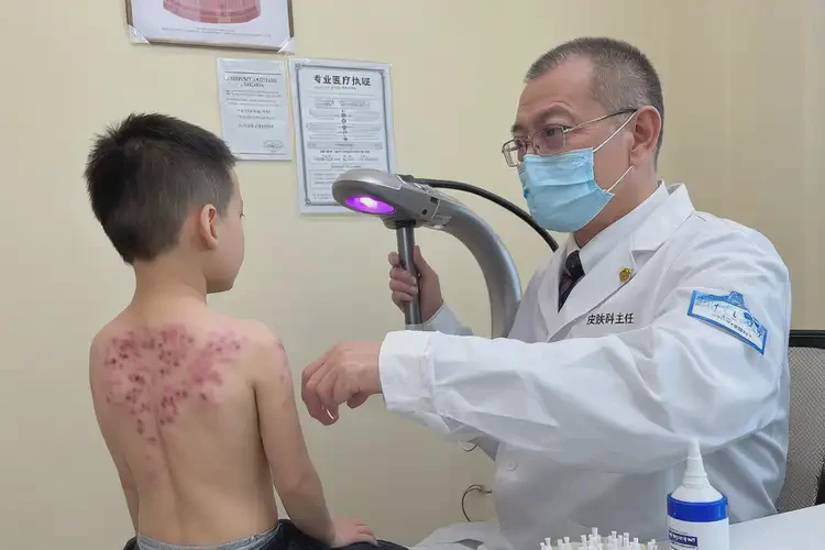 小孩屁股长湿疹不管它会自己好吗(图2)