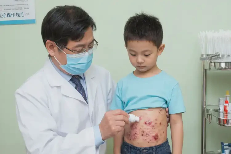 孩子肚子经常长湿疹能治好吗(图3)