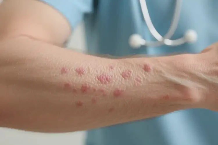 男性手臂上起湿疹能治好吗(图1)