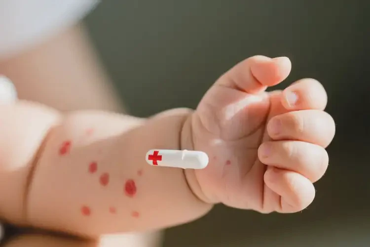 婴儿手臂上起湿疹能治好吗(图1)