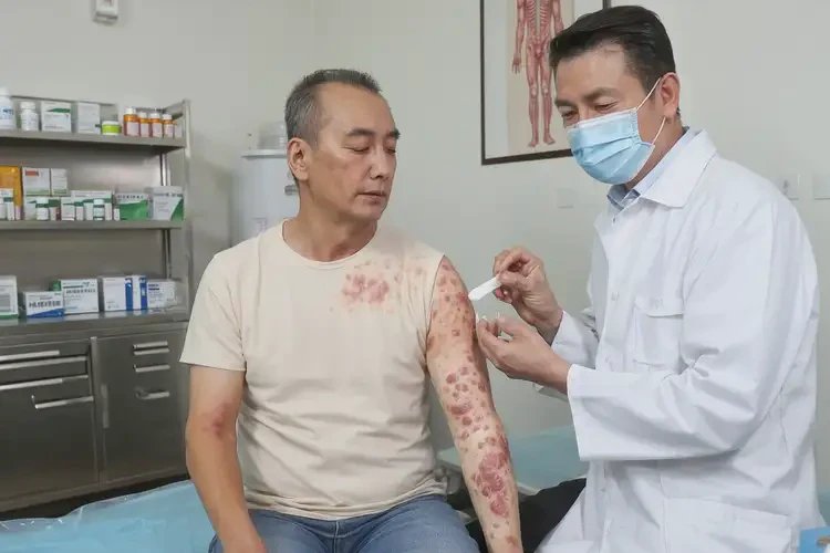 男生身上经常长湿疹可以彻底自愈吗(图3)